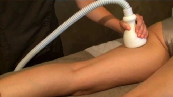 Cryo CelluDrain